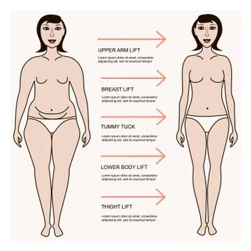 Body correction concept Stock Illustration