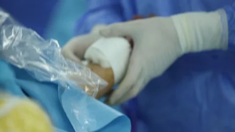 Body part  surgery 2 Video stock 317081052