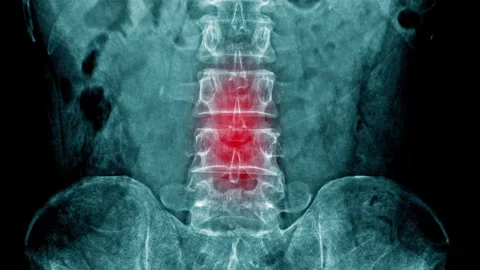 Body structure blue with red hight light Video stock 148643314