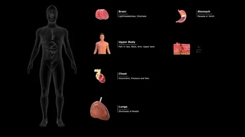 Body-Symptoms-Map Stock Footage 314110509