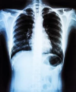 Body x-ray Stock Photos