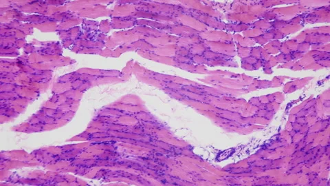 Bodybuilder muscles. Effect of Anabolics and growth hormones. Human skeletal Stock Footage 252806709