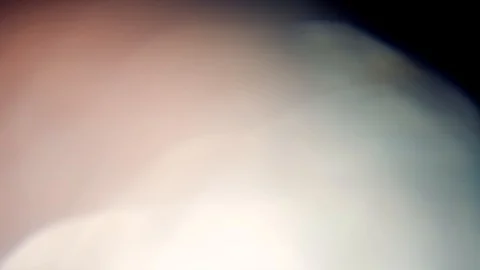 Bokeh light effect abstract background, animation of sparkle circles Stock Footage 125641610