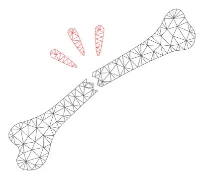 Bone Break Polygonal Frame Vector Mesh Illustration Stock Illustration
