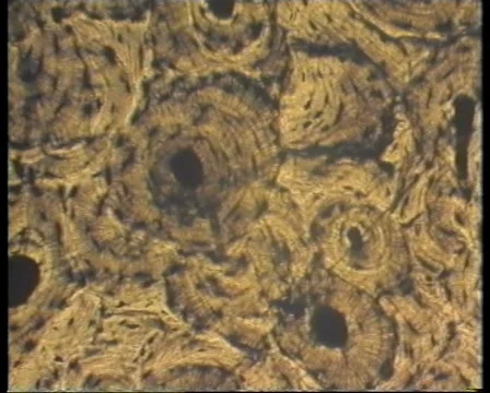 Bone Cells-JPEG 75 PAL 스톡 동영상 5165981