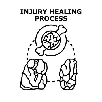 Bone injury healing process vector concept Stock Illustration