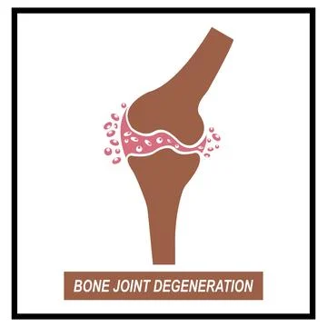Bone joint degeneration icon Stock Illustration