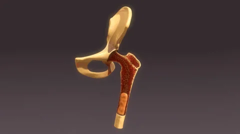 Bone Marrow Video stock 68632766