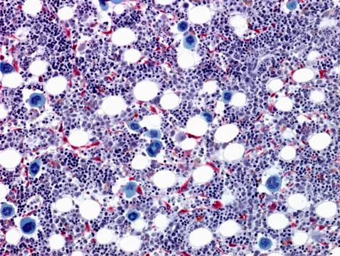 Bone marrow, light micrograph Stock Photos