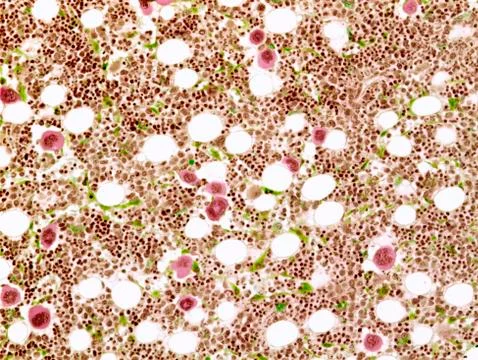 Bone marrow, light micrograph Stock Photos