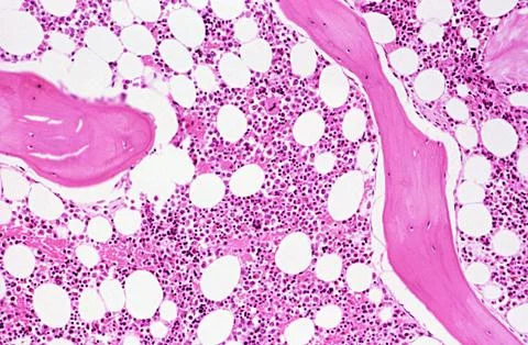 Bone marrow Stock Photos