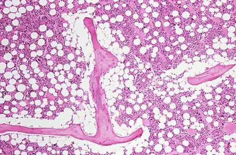 Bone marrow Stock Photos