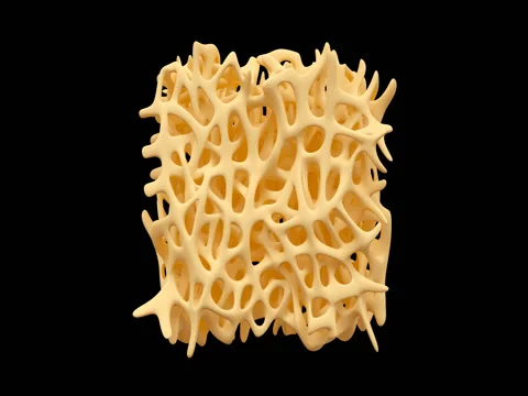 Bone osteoporosis animation Stock Footage 69556342