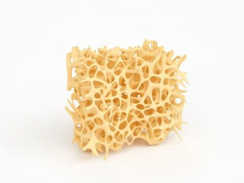 Bone structure part with osteoporosis isolated on white Stock Illustration