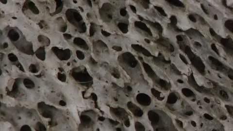 Bone structure with pores in cross-section Stock Footage 337641242