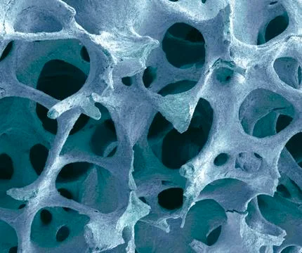 Bone tissue, sem Stock Photos