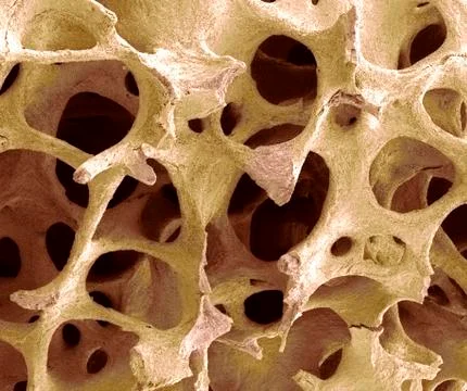 Bone tissue, sem Stock Photos