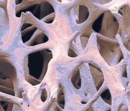 Bone tissue, SEM Stock Photos