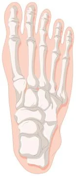 Bone x-ray for gout toe Stock Illustration