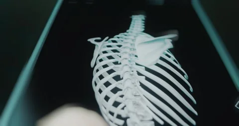Bones of back side of female skeleton Stock Footage 313839216