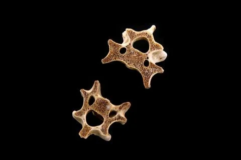 Bones in a black background Stock Photos