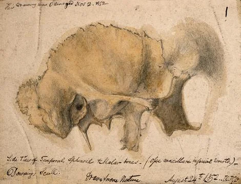 Bones of the cheek: side view of the temporal, schenoid and malar bones. Pe.. Stockillustratie