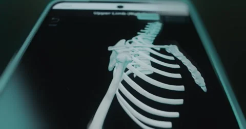 Bones of female upper limb right side Stock Footage 313839133