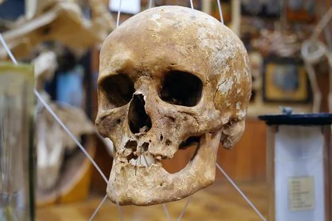 Bones of human skull for studying. Human skull Stockfoto's