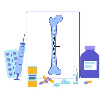 Bones template concept Stock Illustration