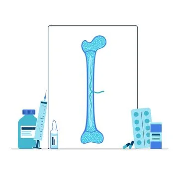 Bones template concept Stock Illustration