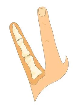 Bones type skeleton. Educational anatomical diagram element. Bone example Stock Illustration