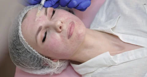 Botox Inject, Mesotherapy, Botulinum Therapy, Biorevitalization Or Plasma Stock Footage 153869306