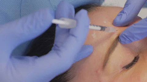Botox Injecting Above The Eyebrow Stock Footage 130950580