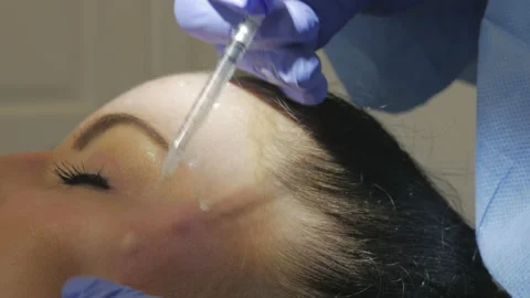 Botox Injecting In The Cheekbone Stock Footage 130943316