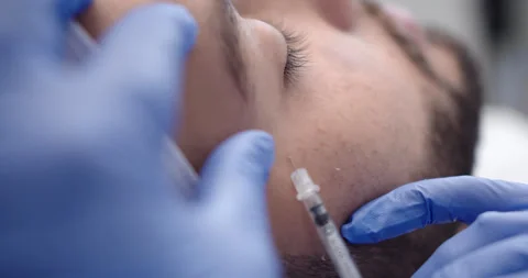botox injection into the face of a young... | Stock Video | Pond5