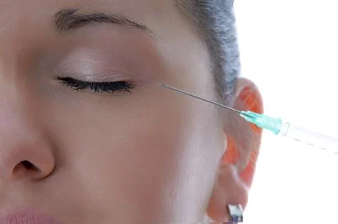 Botox injection Foto stock