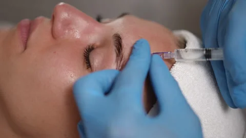 The Botox Injection Procedure is a widely recognized technique for achieving Stock Footage 317409431