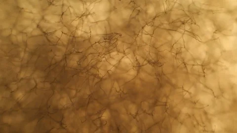 Botrytis cinerea hypae seen through an optical microscope in a microbiology labo Stock Footage 117275322