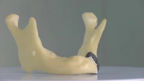 The bottom of a jaw printed in 3D used for medical implant is spinning. Stock Footage 81852872