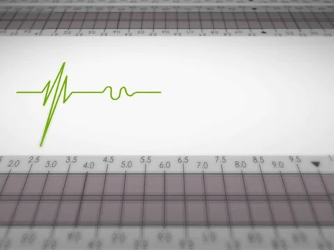 Bottom View - Close up - monitor - heartbeat line - green - SD Stock Footage