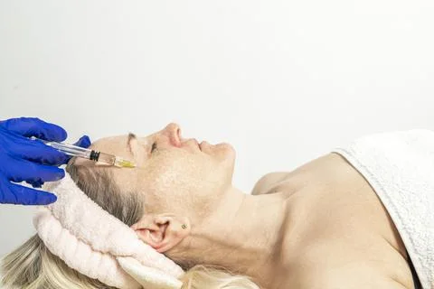 Botulinum toxin injection on eye area, for lifting skin around eyes, mesother Stock Photos