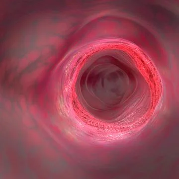 Bowel disease an inflammation inside the colon or intestinal tract 스톡 일러스트