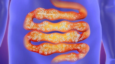 Bowel Flatulence treatment Stock Footage 79092145