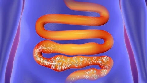 Bowel Flatulence treatment. Stock Footage 80657523