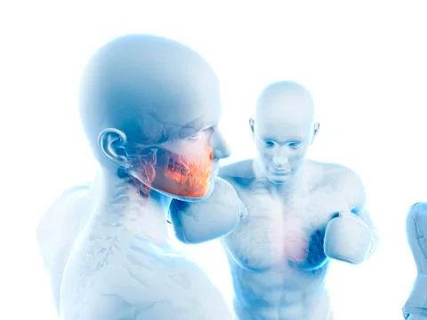 Boxing match, artwork Illustrazione stock