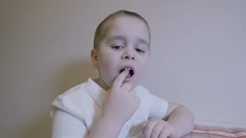 A Boy Aged 5-6 Years Experienced Loose Front Teeth. Children Dentistry Concept. Stock Footage 304105790