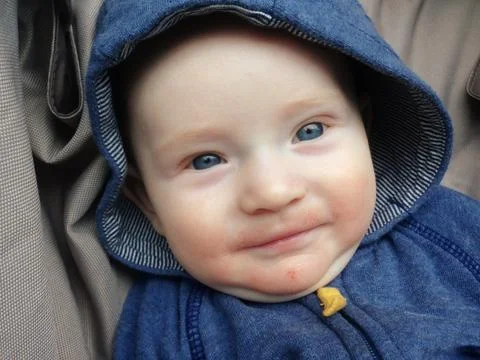 A boy with  allergy Stock Photos