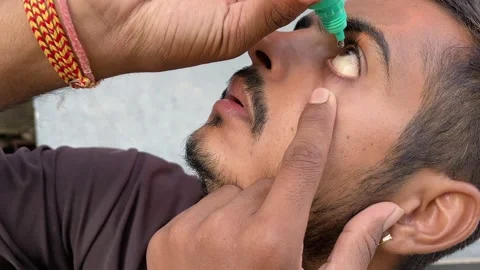 Boy Applying Eye Drops Close-Up for Eye Care in 4K Stock Footage 321629974