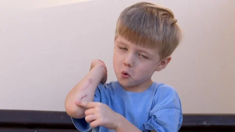 Boy bends down to look at fresh elbow scrape with curiosity, showing early Video stock 321817404
