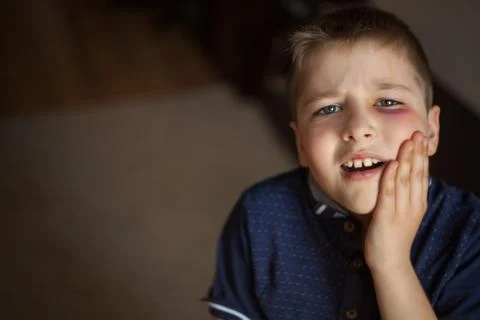 A boy with a black eye Stock Photos